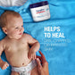 Aquaphor Baby Healing Ointment for Diaper Rash and More, 7 OZ | Baby Skin Protectant with Petrolatum for Chapped or Dry Skin, Drool Rash and Diaper Rash, Hypoallergenic, Fragrance Free